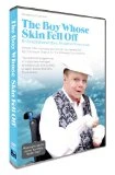 The Boy Whose Skin Fell Off DVD - Jonny Kennedy, Nell McAndrew 